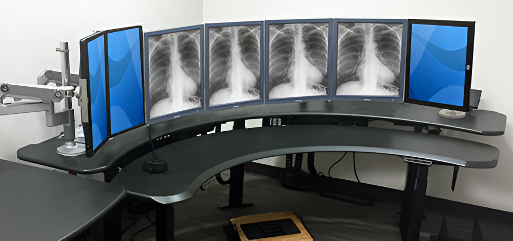 Reduce Radiology Burnout with Simple Ergonomic Adjustments